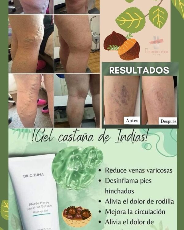 Gel de Castaña de Indias Pferde